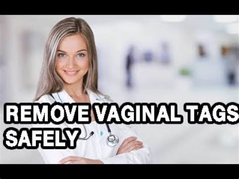 As a skin tag, it is a widespread problem which can be treated easily. . Skin tag vagina